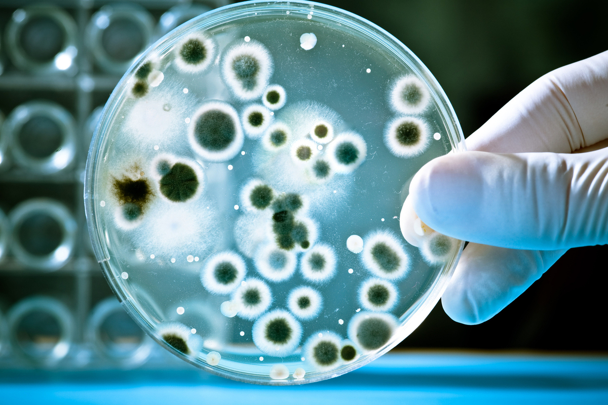 Close up image of microbial colonies in a petri dish
